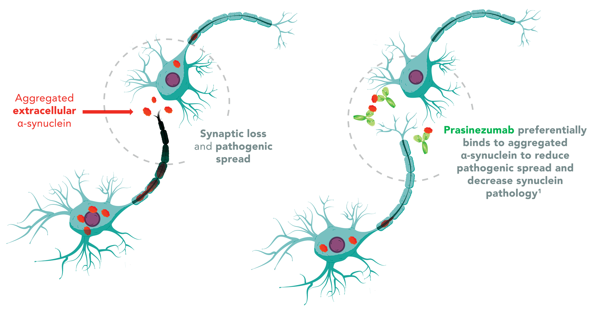 Prasinesumab preferentially binds to aggregated α-synuclein to reduce pathogenic spread and descrease synuclein pathology